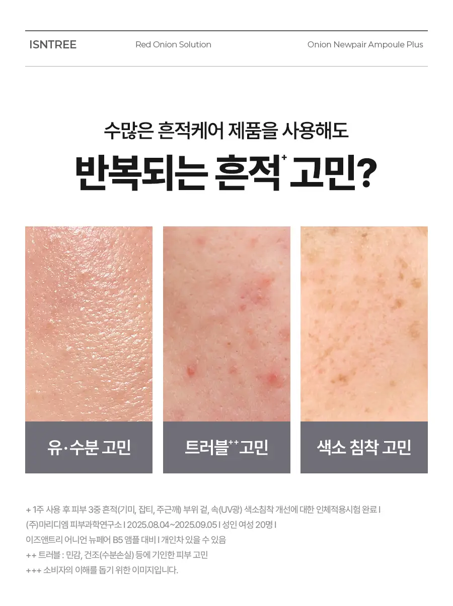 [NCT 재민PICK] 이즈앤트리 어니언 뉴페어 앰플 플러스 50ml 기획 (+겔크림 플러스 20ml) 상세페이지 16